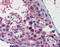 Structural Maintenance Of Chromosomes 3 antibody, 30-301, ProSci, Immunohistochemistry paraffin image 