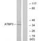 Cytosolic Thiouridylase Subunit 1 antibody, A12568, Boster Biological Technology, Western Blot image 