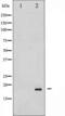 Synuclein Alpha antibody, TA325865, Origene, Western Blot image 