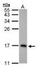 6-Pyruvoyltetrahydropterin Synthase antibody, LS-C186163, Lifespan Biosciences, Western Blot image 