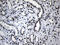 Nucleic Acid Binding Protein 1 antibody, M11516, Boster Biological Technology, Immunohistochemistry paraffin image 