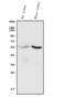 Cytochrome P450 Family 11 Subfamily B Member 1 antibody, A03766-3, Boster Biological Technology, Western Blot image 