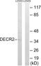 2,4-Dienoyl-CoA Reductase 2 antibody, A11948-1, Boster Biological Technology, Western Blot image 