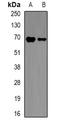 Heat Shock Protein Family B (Small) Member 1 antibody, orb388240, Biorbyt, Western Blot image 