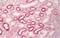 Melanocyte-stimulating hormone receptor antibody, orb84915, Biorbyt, Immunohistochemistry paraffin image 