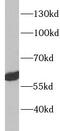 Activin A Receptor Like Type 1 antibody, FNab00131, FineTest, Western Blot image 