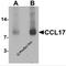 C-C Motif Chemokine Ligand 17 antibody, 7239, ProSci, Western Blot image 