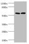 Zinc Finger C3HC-Type Containing 1 antibody, LS-C676733, Lifespan Biosciences, Western Blot image 