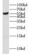 Cytochrome P450 Family 4 Subfamily F Member 11 antibody, FNab02170, FineTest, Western Blot image 