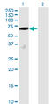 Decapping MRNA 1A antibody, LS-C139520, Lifespan Biosciences, Western Blot image 