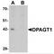 Dolichyl-Phosphate N-Acetylglucosaminephosphotransferase 1 antibody, MBS150075, MyBioSource, Western Blot image 