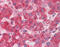 DGCR8 Microprocessor Complex Subunit antibody, ARP40984_P050, Aviva Systems Biology, Immunohistochemistry paraffin image 