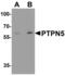 Protein Tyrosine Phosphatase Non-Receptor Type 5 antibody, PA5-72832, Invitrogen Antibodies, Western Blot image 