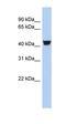 Tyrosine Hydroxylase antibody, orb331556, Biorbyt, Western Blot image 