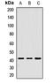 Tropomodulin 1 antibody, LS-C668068, Lifespan Biosciences, Western Blot image 