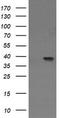 Mitogen-Activated Protein Kinase Kinase 3 antibody, CF505838, Origene, Western Blot image 