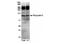 Polycystin 2, Transient Receptor Potential Cation Channel antibody, NBP1-30117, Novus Biologicals, Western Blot image 