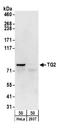 Transglutaminase 2 antibody, A304-229A, Bethyl Labs, Western Blot image 