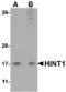 Histidine triad nucleotide-binding protein 1 antibody, A02557, Boster Biological Technology, Western Blot image 