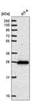 Dehydrogenase/Reductase 2 antibody, PA5-65828, Invitrogen Antibodies, Western Blot image 