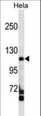 RIPOR Family Member 3 antibody, LS-C159614, Lifespan Biosciences, Western Blot image 