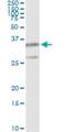 Proteasome Subunit Beta 8 antibody, H00005696-M01, Novus Biologicals, Immunoprecipitation image 
