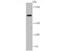 Complement C4A (Rodgers Blood Group) antibody, A01095-2, Boster Biological Technology, Western Blot image 