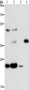 CASP8 And FADD Like Apoptosis Regulator antibody, TA351194, Origene, Western Blot image 