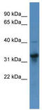 T antibody, TA334030, Origene, Western Blot image 