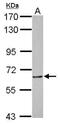 Metastasis Associated 1 Family Member 3 antibody, NBP2-19424, Novus Biologicals, Western Blot image 