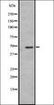 5-hydroxytryptamine receptor 3A antibody, orb335517, Biorbyt, Western Blot image 