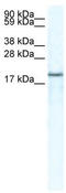 C-X-C Motif Chemokine Ligand 14 antibody, TA330379, Origene, Western Blot image 