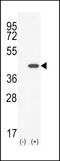 C-type lectin domain family 11 member A antibody, 55-616, ProSci, Western Blot image 