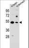 Solute Carrier Family 16 Member 11 antibody, LS-B13587, Lifespan Biosciences, Western Blot image 