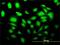 SLC2A4 regulator antibody, H00056731-M02, Novus Biologicals, Immunocytochemistry image 