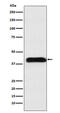 Mannose-6-Phosphate Receptor, Cation Dependent antibody, M01405-1, Boster Biological Technology, Western Blot image 