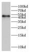 Ubiquitin Conjugating Enzyme E2 D1 antibody, FNab02128, FineTest, Western Blot image 