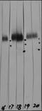 Lysosomal Associated Membrane Protein 1 antibody, orb181505, Biorbyt, Western Blot image 