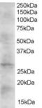 Dickkopf WNT Signaling Pathway Inhibitor 2 antibody, EB05360, Everest Biotech, Western Blot image 