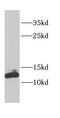 Cyclin-dependent kinase 2-associated protein 1 antibody, FNab01555, FineTest, Western Blot image 