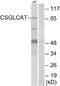 Chondroitin Polymerizing Factor 2 antibody, A30609, Boster Biological Technology, Western Blot image 