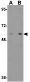 Rab5 GDP/GTP exchange factor antibody, GTX32007, GeneTex, Western Blot image 