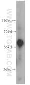 Alpha 2-HS Glycoprotein antibody, 16571-1-AP, Proteintech Group, Western Blot image 