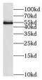 Ribosomal Oxygenase 2 antibody, FNab05190, FineTest, Western Blot image 