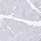 Pre-mRNA branch site protein p14 antibody, HPA034830, Atlas Antibodies, Immunohistochemistry paraffin image 