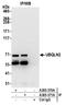 Ubiquilin 2 antibody, A305-371A, Bethyl Labs, Immunoprecipitation image 