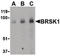 BR Serine/Threonine Kinase 1 antibody, LS-B181, Lifespan Biosciences, Western Blot image 