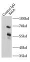 Glutaminase antibody, FNab04519, FineTest, Immunoprecipitation image 