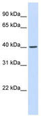 F-Box Protein 28 antibody, TA333838, Origene, Western Blot image 
