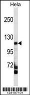 RIPOR Family Member 3 antibody, 59-603, ProSci, Western Blot image 